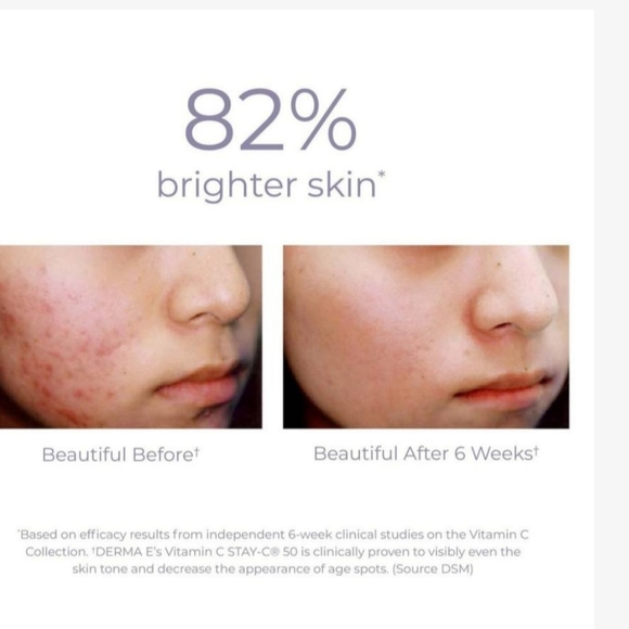 Derma.E Vitamin C Serum - Picture 2 of 8